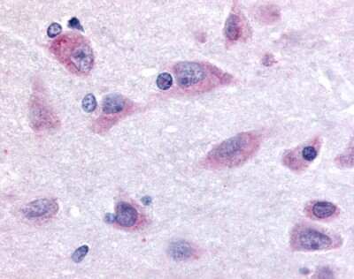 Immunohistochemistry-Paraffin: Prokineticin R2/PROKR2 Antibody [NLS3148] - Analysis of anti-PROKR2 antibody with human brain, neurons and glia.