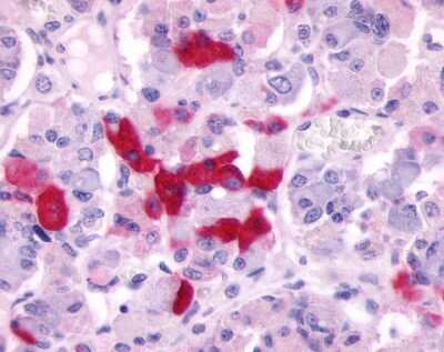 Immunohistochemistry-Paraffin: Prokineticin R2/PROKR2 Antibody [NLS3155] - Analysis of anti-PROKR2 antibody with pituitary