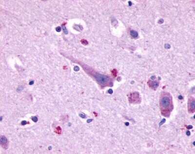 Immunohistochemistry-Paraffin: Prokineticin R2/PROKR2 Antibody [NLS3155] - Analysis of anti-PROKR2 antibody with human brain, neurons and glia at 15 ug/ml.