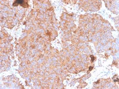 Immunohistochemistry-Paraffin: Prolactin Antibody (PRL/4908R) - Azide and BSA Free [NBP3-08249] - Formalin-fixed, paraffin-embedded human pituitary stained with Prolactin Recombinant Rabbit Monoclonal Antibody (PRL/4908R).