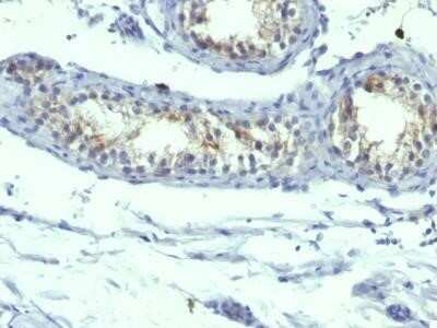 Immunohistochemistry-Paraffin: Prolactin R Antibody (B6.2 + PRLR742) - Azide and BSA Free [NBP2-34555] - Formalin-fixed, paraffin-embedded human Testicular Carcinoma stained with Prolactin Receptor Monoclonal Antibody (B6.2 + PRLR742).