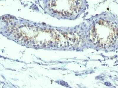 Immunohistochemistry-Paraffin: Prolactin R Antibody (B6.2 + PRLR742) - IHC-Prediluted [NBP2-44626] - Formalin-fixed, paraffin-embedded human Testicular Carcinoma stained with Prolactin Receptor Monoclonal Antibody (B6.2 + PRLR742).