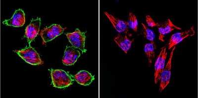 Immunocytochemistry/Immunofluorescence: Prolactin R Antibody (T6) [NB300-531] - Cells were grown on chamber slides and fixed with formaldehyde prior to staining. Cells were probed without (control) or with a Prolactin Receptor monoclonal antibody at a dilution of 1:200 overnight at 4 C, washed with PBS and incubated with a DyLight-488 conjugated secondary antibody and nuclei with DAPI (blue) is shown.