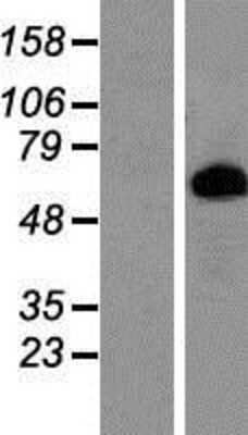 Western Blot Prolactin R Overexpression Lysate