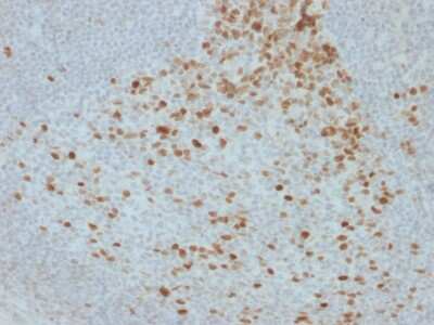 Immunohistochemistry-Paraffin: Proliferation Marker Antibody (JC1) - Azide and BSA Free [NBP3-08342] - Formalin-fixed, paraffin-embedded human Lymph Node stained with Proliferation Marker Mouse Monoclonal Antibody (JC1).