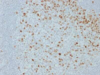 Immunohistochemistry-Paraffin: Proliferation Marker Antibody (JC1) - Azide and BSA Free [NBP3-08342] - Formalin-fixed, paraffin-embedded human Lymph Node stained with Proliferation Marker Mouse Monoclonal Antibody (JC1).