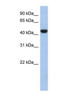 Western Blot: Proline Rich 30 Antibody [NBP1-91464] - 721_B cell lysate, concentration 0.2-1 ug/ml.