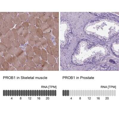 Immunohistochemistry-Paraffin Proline-Rich Basic Protein 1 Antibody - BSA Free