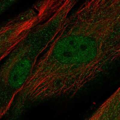 Immunocytochemistry/Immunofluorescence: Proline rich 16 Antibody [NBP2-13814] - Staining of human cell line BJ shows localization to nucleus & cytosol.