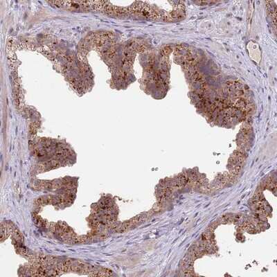 Immunohistochemistry-Paraffin: Proline rich 16 Antibody [NBP2-13814] - Staining of human prostate shows strong cytoplasmic positivity in glandular cells.