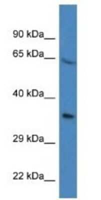 Western Blot: Proline rich 16 Antibody [NBP1-79655] - Mouse Kidney Lysate 1ug/ml  Gel Concentration 12%