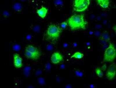 Immunocytochemistry/Immunofluorescence: Proprotein Convertase 7/PCSK7 Antibody (OTI1B8) [NBP2-02106] - Staining of COS7 cells transiently transfected by pCMV6-ENTRY PCSK7.