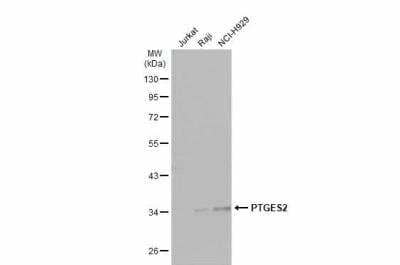 Western Blot: Prostaglandin E Synthase 2/PTGES2 Antibody [NBP1-33411] - Various whole cell extracts (30 ug) were separated by 10% SDS-PAGE, and the membrane was blotted with PTGES2 antibody [N2C3] diluted at 1:1000. The HRP-conjugated anti-rabbit IgG antibody (NBP2-19301) was used to detect the primary antibody.