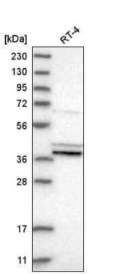 Western Blot: Prostaglandin E Synthase 2/PTGES2 Antibody [NBP2-58108] - Analysis in human cell line RT-4.