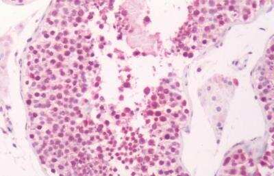 Immunohistochemistry-Paraffin: Prostaglandin E Synthase Antibody [NB110-39057] - Immunohistochemical analysis of human testis.