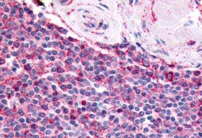Immunohistochemistry-Paraffin: Prostaglandin E Synthase Antibody [NB110-39057] - Anti-Prostaglandin E Synthase antibody IHC of human spleen. Immunohistochemistry of formalin-fixed, paraffin-embedded tissue after heat-induced antigen retrieval.