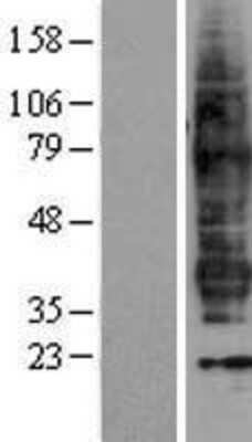 Western Blot: Prostaglandin F2 alpha Receptor Overexpression Lysate (Adult Normal) [NBL1-14938] Left-Empty vector transfected control cell lysate (HEK293 cell lysate); Right -Over-expression Lysate for Prostaglandin F2 alpha Receptor.