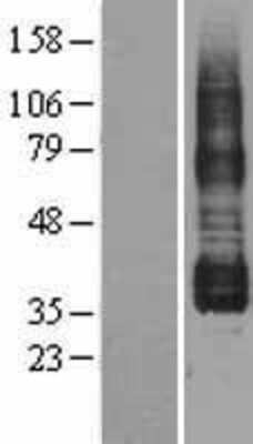 Western Blot: Prostaglandin I2 Receptor Overexpression Lysate (Adult Normal) [NBL1-14939] Left-Empty vector transfected control cell lysate (HEK293 cell lysate); Right -Over-expression Lysate for Prostaglandin I2 Receptor.