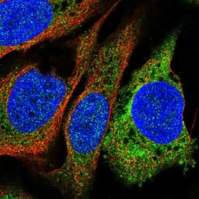 Immunocytochemistry/Immunofluorescence: Prostaglandin I2 Synthase Antibody [NBP2-68701] - Staining of human cell line U-2 OS shows localization to endoplasmic reticulum.