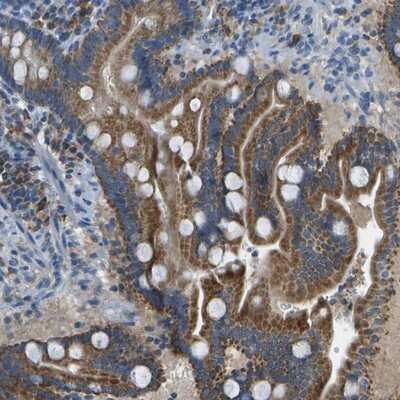 Immunohistochemistry-Paraffin: Prostaglandin I2 Synthase Antibody [NBP1-85359] - Staining of human duodenum shows strong cytoplasmic positivity in glandular cells.