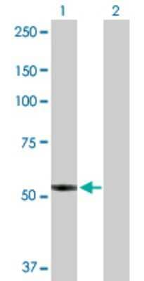 Western Blot: Prostaglandin I2 Synthase Antibody [H00005740-D01P] - Analysis of PTGIS expression in transfected 293T cell line by PTGIS polyclonal antibody.Lane 1: PTGIS transfected lysate(57.10 KDa).Lane 2: Non-transfected lysate.