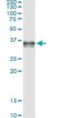 Immunoprecipitation: Prostasin/Prss8 Antibody (3C4) [H00005652-M11A] - Analysis of PRSS8 transfected lysate using anti-PRSS8 monoclonal antibody and Protein A Magnetic Bead, and immunoblotted with PRSS8 rabbit polyclonal antibody.
