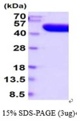 SDS-Page: Recombinant Human Prostatic Acid Phosphatase/ACPP Protein [NBP2-52365] -  15% SDS Page (3 ug)