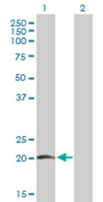 Western Blot: Prosurfactant Protein C Antibody [H00006440-B01P] - Analysis of SFTPC expression in transfected 293T cell line by SFTPC polyclonal antibody.  Lane 1: SFTPC transfected lysate(21.67 KDa). Lane 2: Non-transfected lysate.