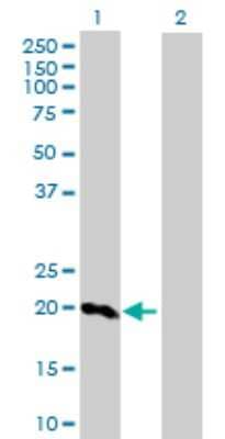 Western Blot: Prosurfactant Protein C Antibody [H00006440-D01P] - Analysis of SFTPC expression in transfected 293T cell line by SFTPC rabbit polyclonal antibody.Lane 1: SFTPC transfected lysate(21.10 KDa).Lane 2: Non-transfected lysate.