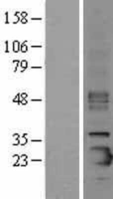 Western Blot: Prosurfactant Protein C Overexpression Lysate (Adult Normal) [NBL1-15896] Left-Empty vector transfected control cell lysate (HEK293 cell lysate); Right -Over-expression Lysate for Prosurfactant Protein C.