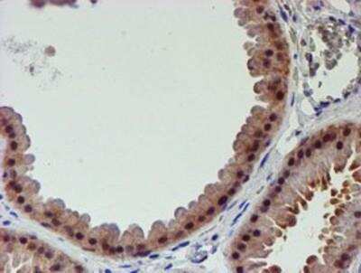 Immunohistochemistry-Paraffin: Proteasome 19S 10B Antibody (1G6) [NBP2-00990] - Staining of paraffin-embedded Human breast tissue using anti-Proteasome 19S 10B mouse monoclonal antibody.