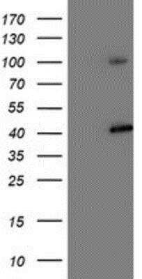 Western Blot: Proteasome 19S 10B Antibody (1G6) [NBP2-00990] - HEK293T cells were transfected with the pCMV6-ENTRY control (Left lane) or pCMV6-ENTRY Proteasome 19S 10B (Right lane) cDNA for 48 hrs and lysed. Equivalent amounts of cell lysates (5 ug per lane) were separated by SDS-PAGE and immunoblotted with anti-Proteasome 19S 10B.