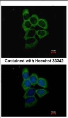 Immunocytochemistry/Immunofluorescence: Proteasome 19S 10B Antibody [NBP2-19950] - Immunofluorescence analysis of methanol-fixed A431, using antibody at 1:500 dilution.