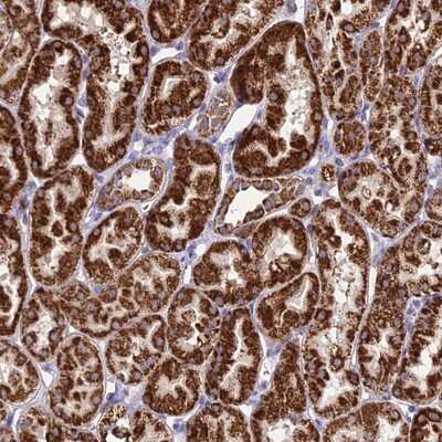 <b>Genetic Strategies Validation. </b>Immunohistochemistry-Paraffin: Proteasome 19S 10B Antibody [NBP1-92291] - Staining of human kidney shows strong cytoplasmic positivity in cells in renal tubules.