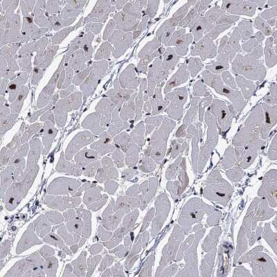 Immunohistochemistry-Paraffin: Proteasome 19S 10B Antibody [NBP3-17019] - Staining of human heart muscle shows high expression.