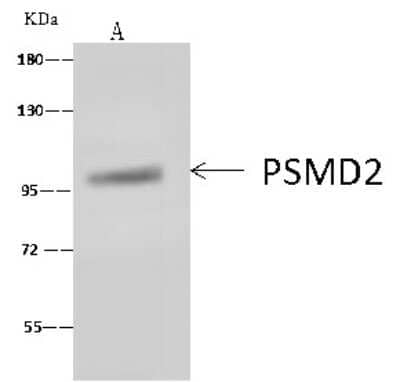 Immunoprecipitation: Proteasome 19S 10B Antibody [NBP2-99616] - Proteasome 19S 10B was immunoprecipitated using: Lane A: 0.5 mg Jurkat Whole Cell Lysate 4 ul anti-Proteasome 19S 10B rabbit polyclonal antibody and 60 ug of Immunomagnetic beads Protein A/G.  Primary antibody: Anti-Proteasome 19S 10B rabbit polyclonal antibody, at 1:100 dilution. Secondary antibody: Goat Anti-Rabbit IgG (H+L)/HRP at 1/10000 dilution  Developed using the ECL technique. Performed under reducing conditions. Predicted band size: 100 kDa. Observed band size: 100 kDa