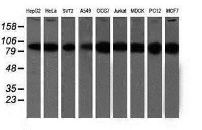 Western Blot: Proteasome 19S 10B Antibody (OTI1G6) - Azide and BSA Free [NBP2-73627] - Analysis of extracts (35ug) from 9 different cell lines by using anti-Proteasome 19S 10B monoclonal antibody.