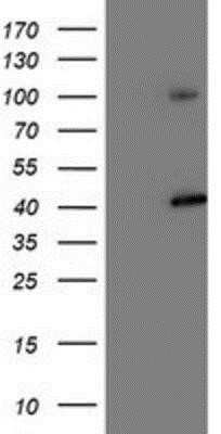Western Blot: Proteasome 19S 10B Antibody (OTI1G6) - Azide and BSA Free [NBP2-73627] - HEK293T cells were transfected with the pCMV6-ENTRY control (Left lane) or pCMV6-ENTRY Proteasome 19S 10B (Right lane) cDNA for 48 hrs and lysed. Equivalent amounts of cell lysates (5 ug per lane) were separated by SDS-PAGE and immunoblotted with anti-Pro