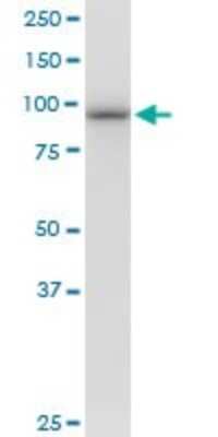 Western Blot: Proteasome 19S 10B Antibody [H00005708-B01P] - Analysis of PSMD2 expression in HeLa.