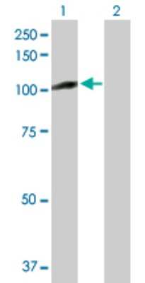 Western Blot: Proteasome 19S 10B Antibody [H00005708-B01P] - Analysis of PSMD2 expression in transfected 293T cell line by PSMD2 polyclonal antibody.  Lane 1: PSMD2 transfected lysate(99.88 KDa). Lane 2: Non-transfected lysate.