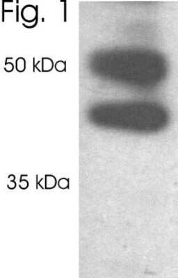 Western Blot: Proteasome 19S 10B Antibody [NB300-532] - Analysis of HeLa cell extract.