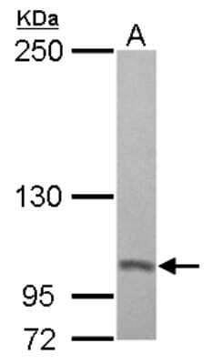 Western Blot: Proteasome 19S 10B Antibody [NBP2-19950] - Sample (30 ug of whole cell lysate) A: A431 5% SDS PAGE gel, diluted at 1:500.