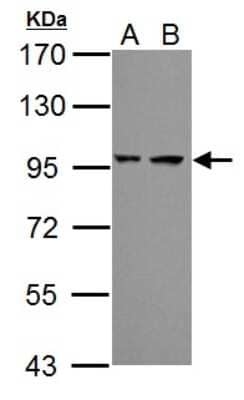 Western Blot: Proteasome 19S 10B Antibody [NBP2-19950] - Sample (30 ug of whole cell lysate) A: JC B: BCL-1 7. 5% SDS PAGE gel, diluted at 1:1000.