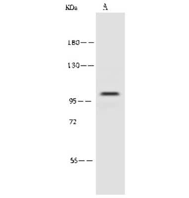 Western Blot: Proteasome 19S 10B Antibody [NBP2-99616] - Anti-Proteasome 19S 10B rabbit polyclonal antibody at 1:500 dilution. Lane A: Jurkat Whole Cell Lysate Lysates/proteins at 30 ug per lane. Secondary Goat Anti-Rabbit IgG (H+L)/HRP at 1/10000 dilution. Developed using the ECL technique. Performed under reducing conditions. Predicted band size: 100 kDa. Observed band size: 100 kDa