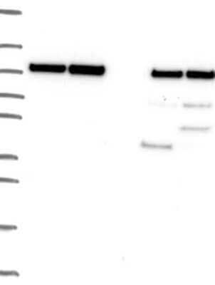 Western Blot: Proteasome 19S 10B Antibody [NBP3-17019] - Lane 1: Marker [kDa] 250, 130, 95, 72, 55, 36, 28, 17, 10;   Lane 2: RT4;   Lane 3: U-251 MG;   Lane 4: Human Plasma;   Lane 5: Liver;   Lane 6: Tonsil