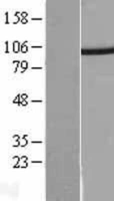 Western Blot: Proteasome 19S 10B Overexpression Lysate (Adult Normal) [NBL1-14900] Left-Empty vector transfected control cell lysate (HEK293 cell lysate); Right -Over-expression Lysate for Proteasome 19S 10B.