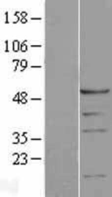 Western Blot: Proteasome 19S S4 Overexpression Lysate (Adult Normal) [NBL1-14886] Left-Empty vector transfected control cell lysate (HEK293 cell lysate); Right -Over-expression Lysate for Proteasome 19S S4.