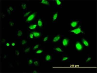 Immunocytochemistry/Immunofluorescence: Proteasome 19S S7 Antibody (4C10-2C8) [H00005701-M01] - Analysis of monoclonal antibody to PSMC2 on HeLa cell. Antibody concentration 10 ug/ml.