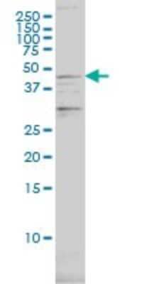 Western Blot Proteasome 19S S7 Antibody (4C10-2C8)