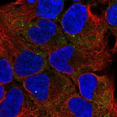 Immunocytochemistry/Immunofluorescence: Proteasome 19S S7 Antibody [NBP2-56743] - Staining of human cell line HEK 293 shows localization to cytosol & cytoplasmic bodies.